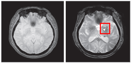  引用：疾病管理庁