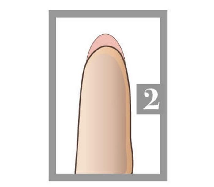 애니멀플래닛