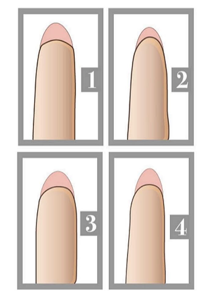 애니멀플래닛