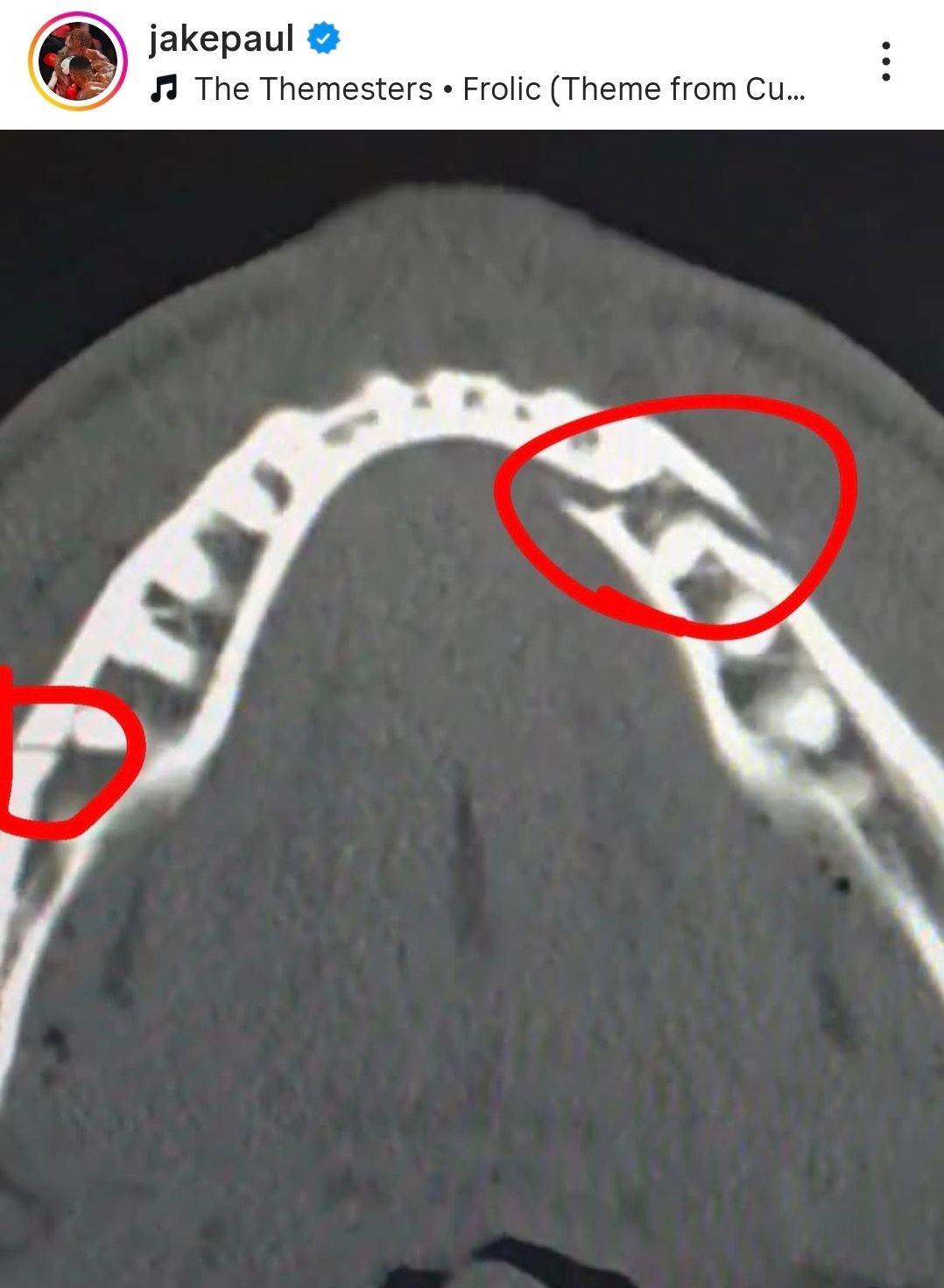 引用:ジェイク・ポールのInstagram