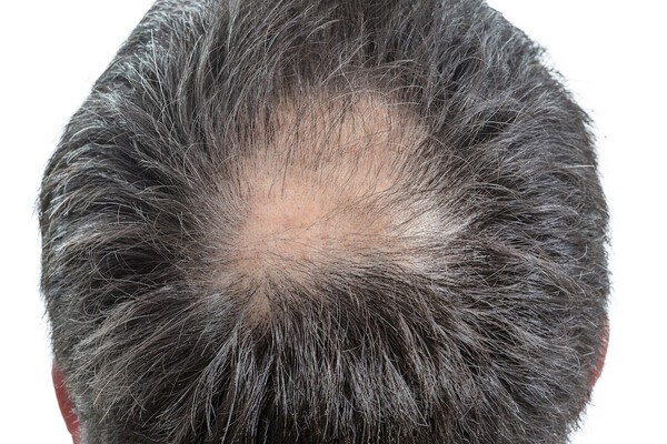 hairmedical
