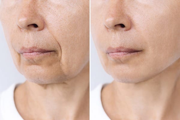shinagawa-skin