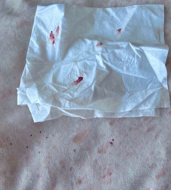 ameblo