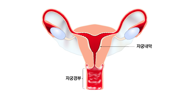 자궁