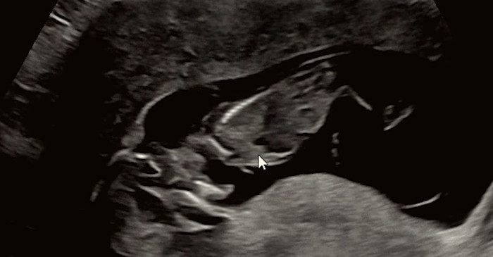  引用：YouTubeチャンネル「ピョンビ夫婦」