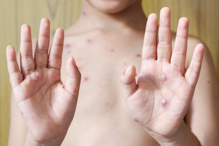 ⓒ게티이미지뱅크