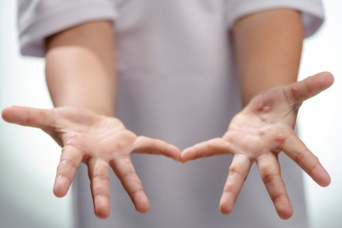 ⓒ게티이미지뱅크