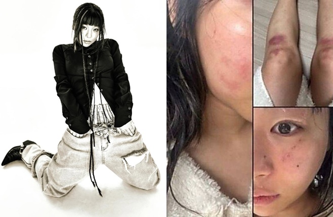 티브이데일리 포토