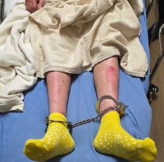 희귀 피부 질환을 앓고 있는 리비아 남성이 이민세관집행국(ICE) 시설에 구금된 모습. 사진=KSTP 캡처