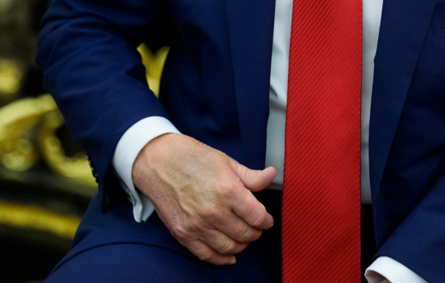 트럼프 대통령 손에 보이는 멍. 사진=UPI 연합뉴스