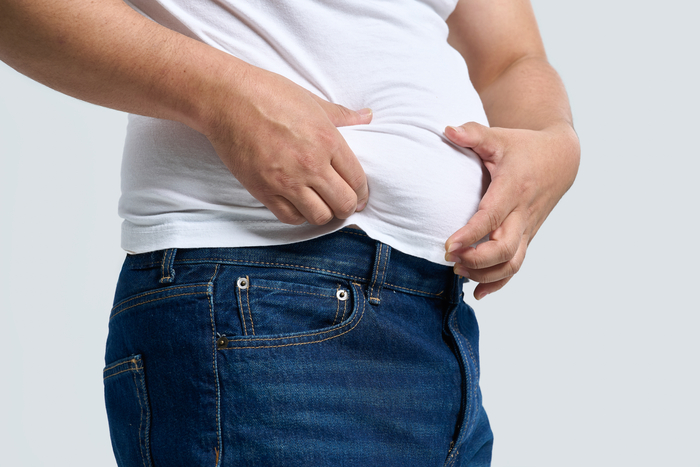 비만으로 인해 체질량지수(BMI)가 높은 사람일수록 치매에 걸릴 가능성이 커질 수 있다는 연구 결과가 나왔다. 사진=게티이미지