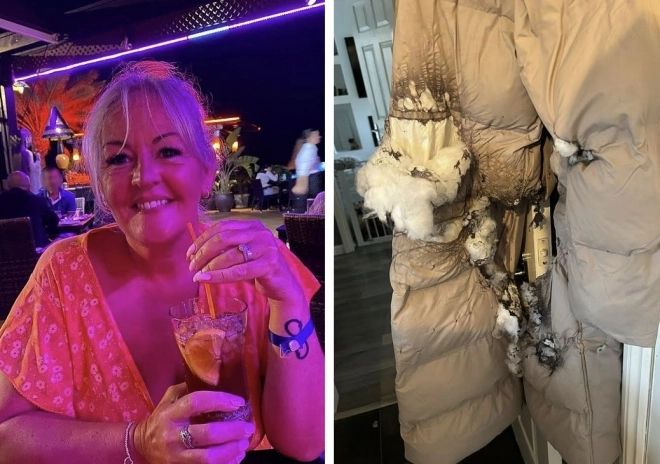 전자담배 폭발로 다리에 심한 화상을 입은 케리 로버츠(52)씨와 폭발 당시 입고 있던 코트. 사진=데일리메일 캡처