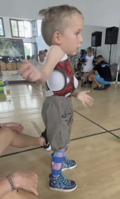 척수성 근위축증(SMA)을 앓는 영국 어린이가 1회 접종 가격이 34억원에 달하는 주사를 맞고 걷게 됐다. 사진=인스타그램