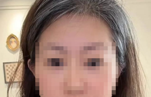자신의 20년 지기 절친과 남편이 부적절한 관계를 맺고 있었다는 사실을 알게 된 뒤 극심한 충격과 스트레스로 단 하루 만에 백발이 되어버린 중국 여성의 사연이 전해졌다. 사진=바이두