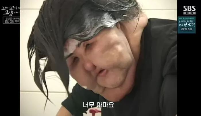 引用：SBS『尾に尾を噛むその日の物語』