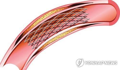 (사진출처: 연합뉴스)