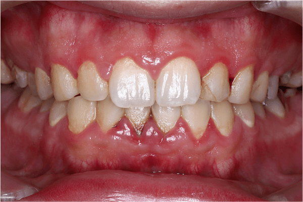 oral-care