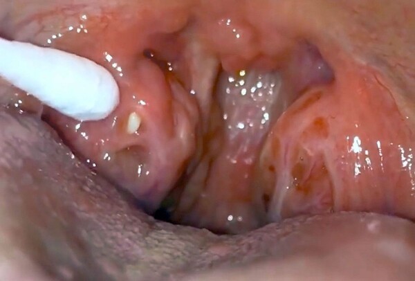 health.udn.com