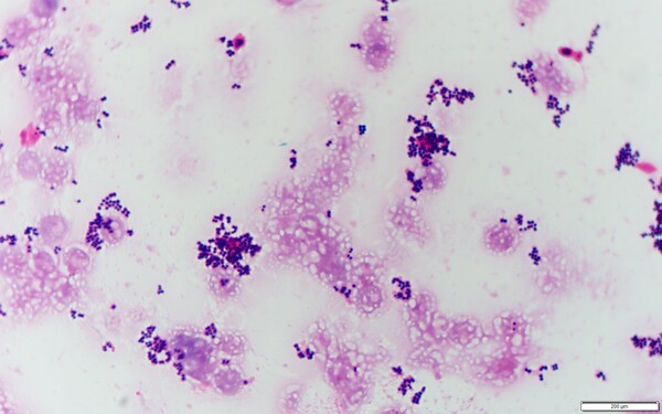 gram-stain