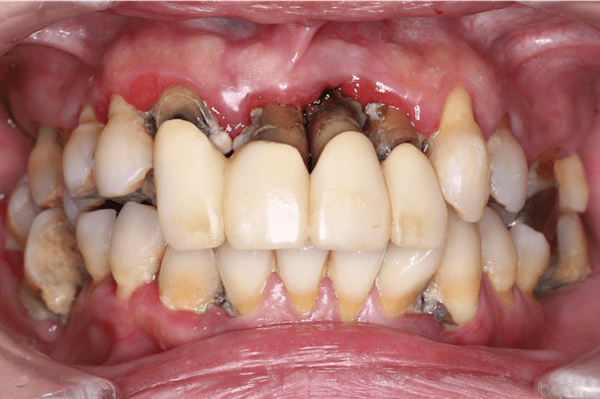 oral-care