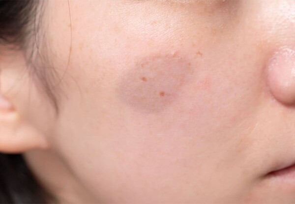 skinnaviclinic
