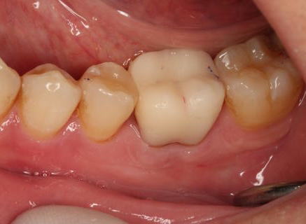 edo-dental