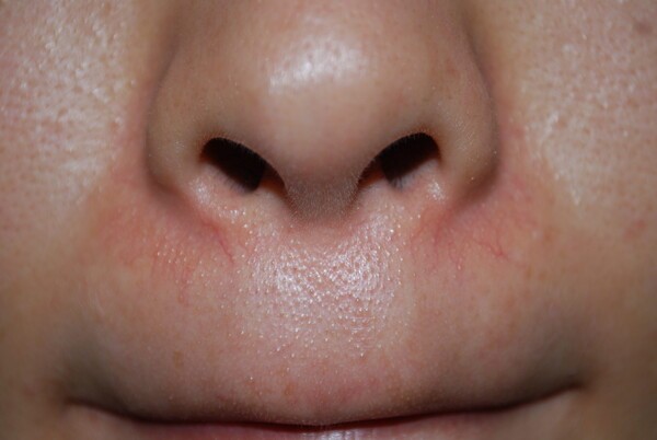 musashikosugi-derma
