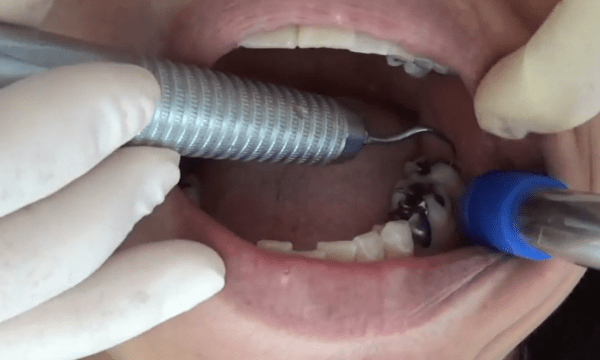 *Dental TV*マウスピース矯正歯科医Taka