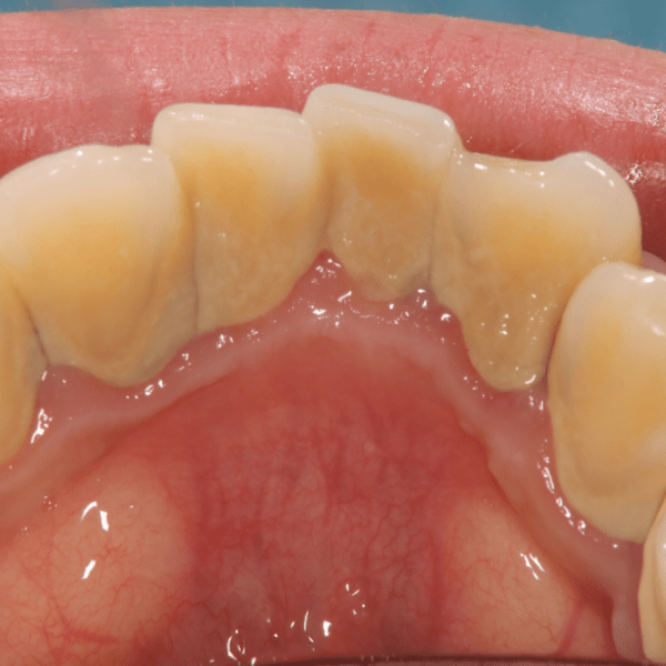 ohkubo-dental