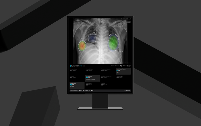 루닛 흉부 엑스레이 AI 영상분석 솔루션 ‘루닛 인사이트 CXR4’ ⓒ루닛
