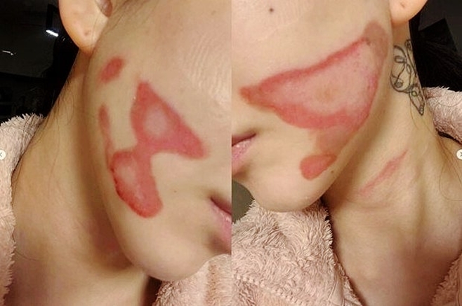 티브이데일리 포토