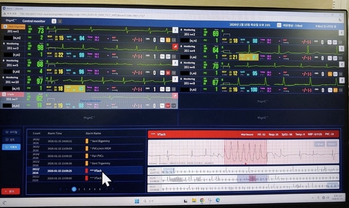 씽크 원격 모니터링 화면에 심실빈맥이 감지된 모습.