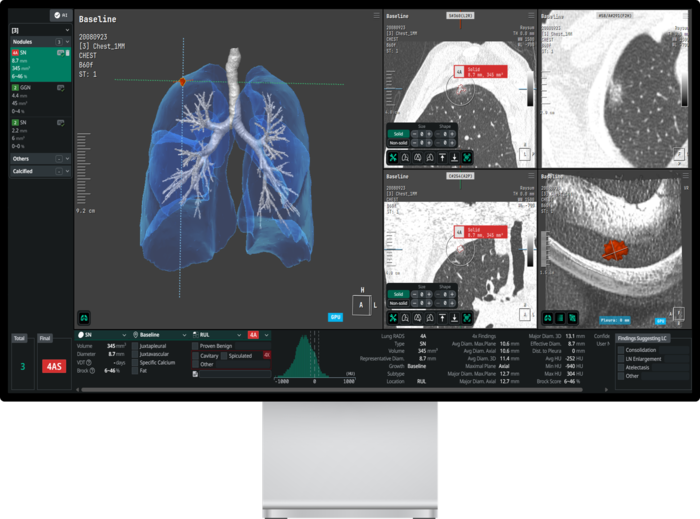 코어라인소프트 '에이뷰 LCS 플러스'