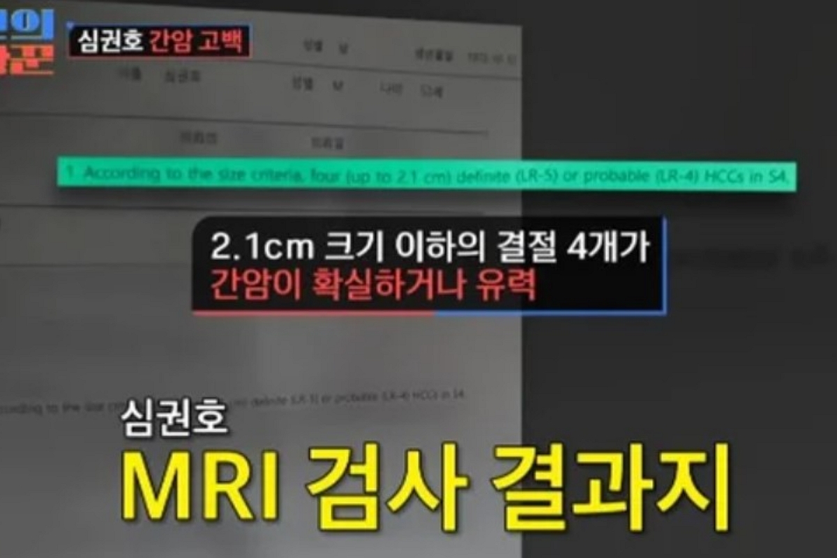 출처 : TV CHOSUN ‘조선의 사랑꾼’