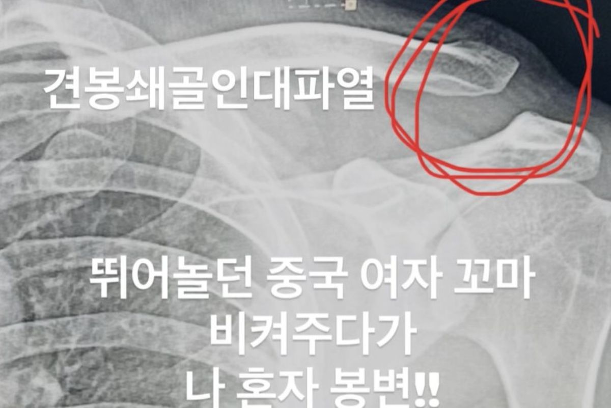 출처: 이켠 SNS 