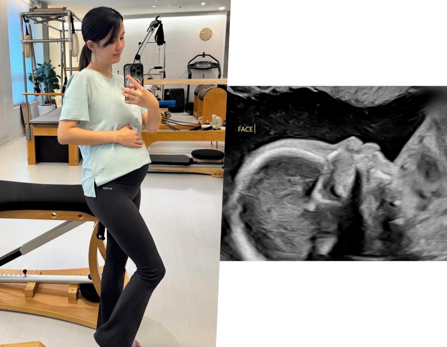 사진 : 남보라 인스타그램