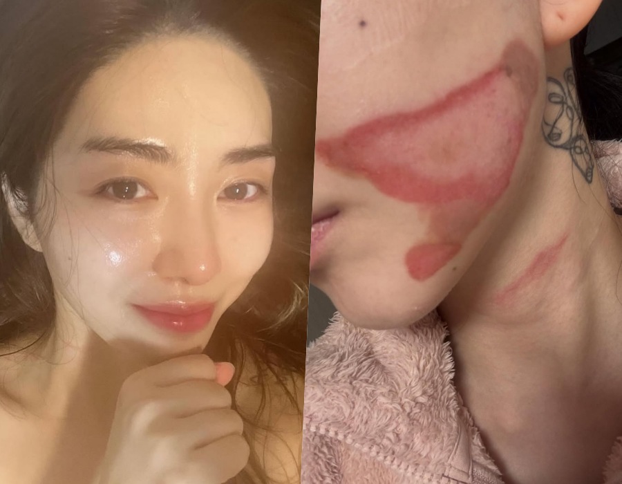 사진 : 권민아 인스타그램