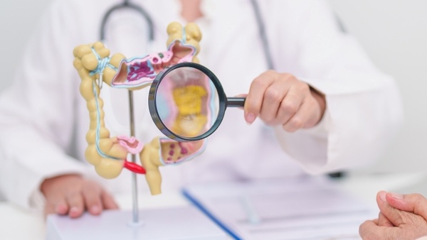 젊은층에서 대장암이 빠르게 늘어나는 가운데, 그 원인이 어린 시절 형성된 장내 세균과 관련 있을 수 있다는 분석이 제기됐다. [사진: 셔터스톡]