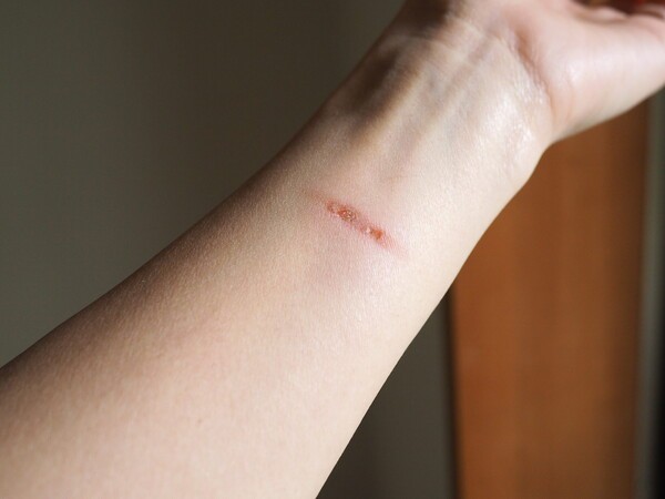 gondo-dermatology