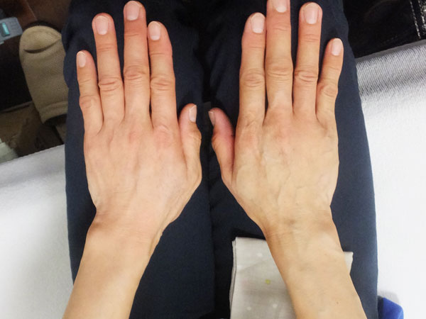 hand-vein