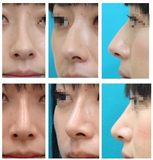 plastic-aesthetic-surgery.jp