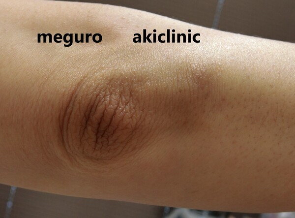 akiclinic-meguro.com