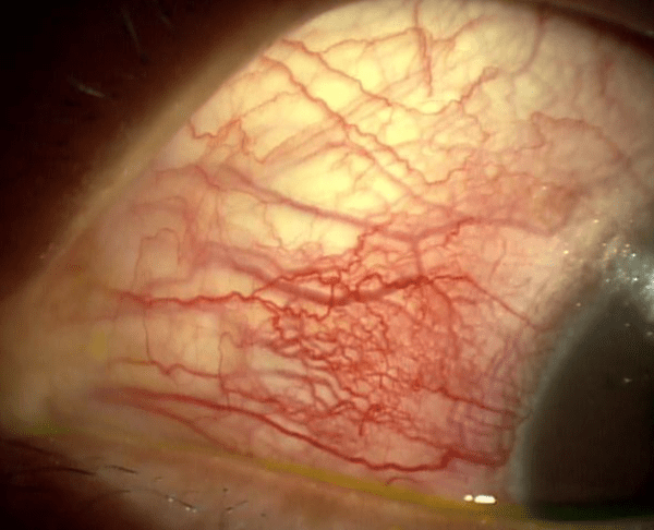 kyo-eye.org