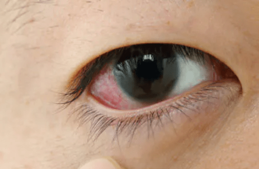 tokami-eye.clinic