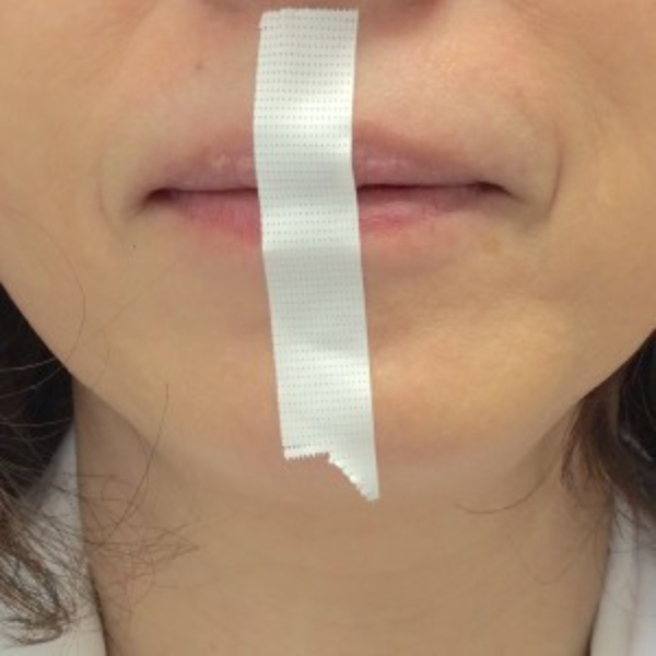 dental-t