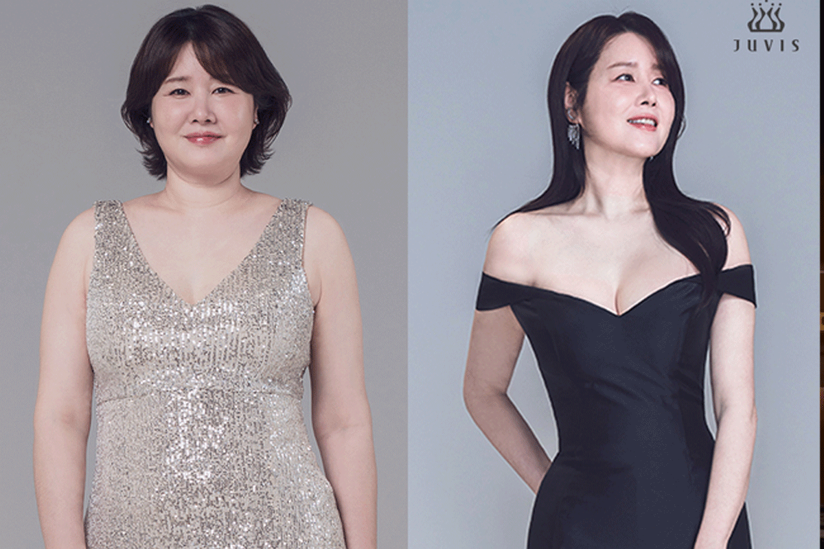 출처 : 쥬비스 다이어트