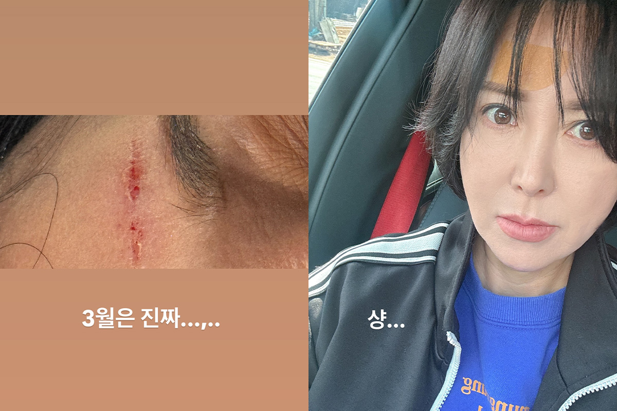 출처 : 이상아 SNS