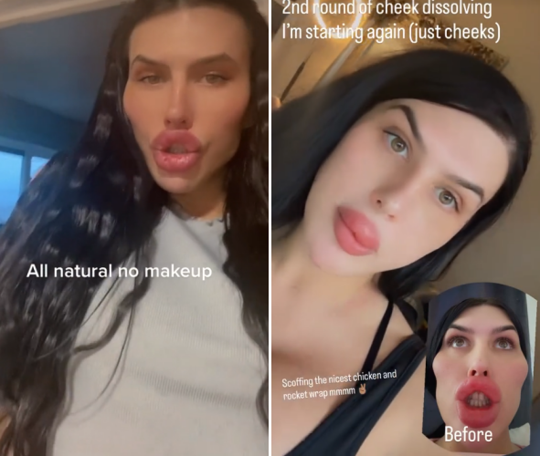 ⓒ소피아 립스 SNS 갈무리