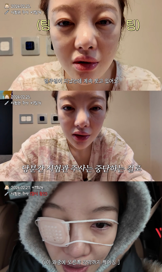 황보라