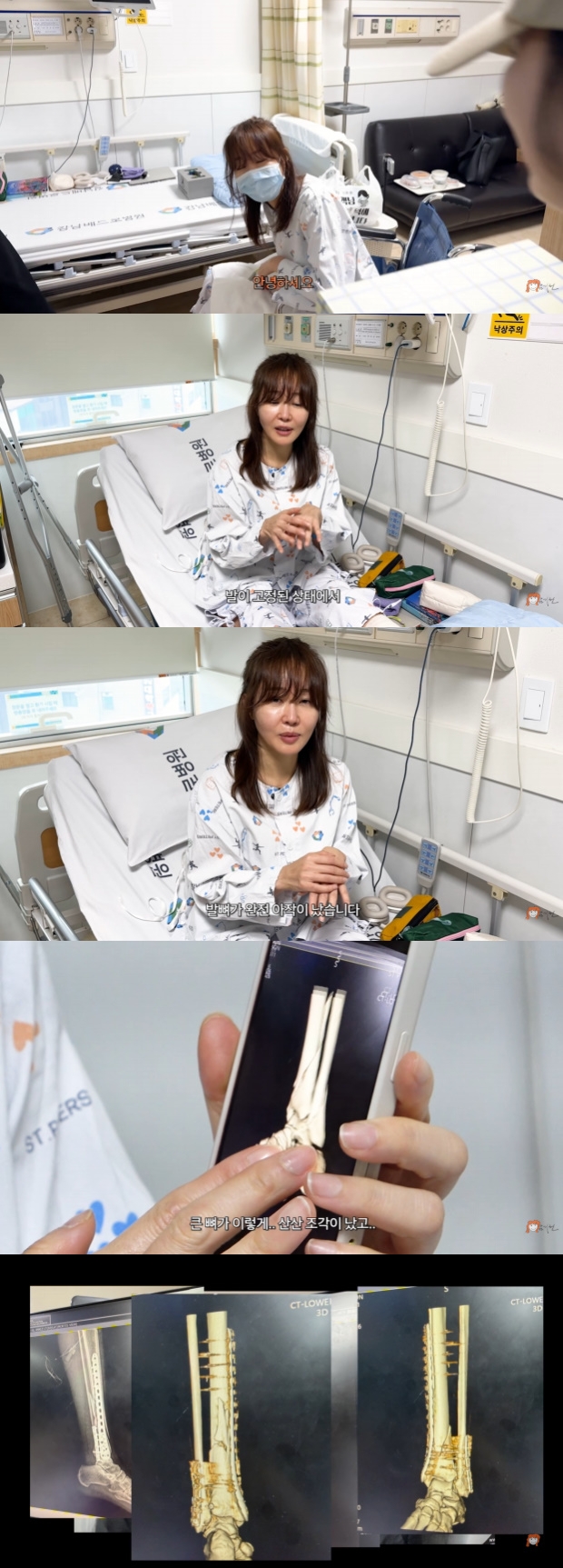 티브이데일리 포토